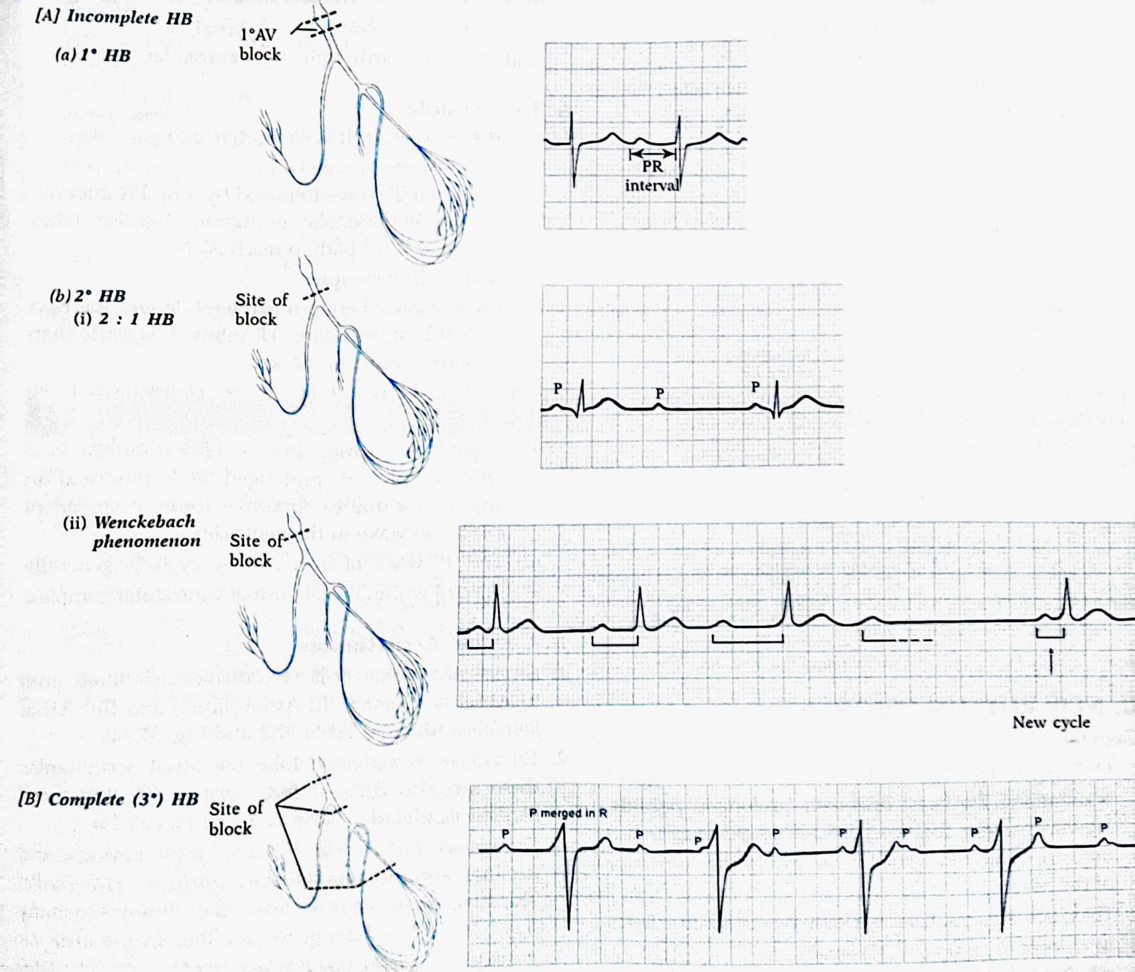 Cardio-vascular homeostasis | Physiologyqa